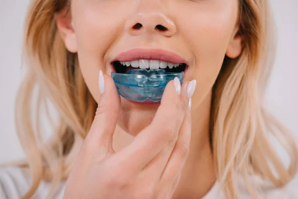 Partial view of woman putting on orthodontic trainer dental braces isolated on white — Stock Photo