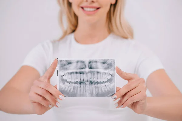 Vista cortada da mulher em t-shirt segurando dentes raio-x isolado em branco — Fotografia de Stock