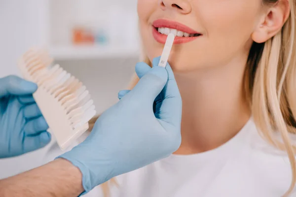 Cropped view of male dentist matching teeth color of woman with palette in clinic, teeth whitening concept — Stock Photo