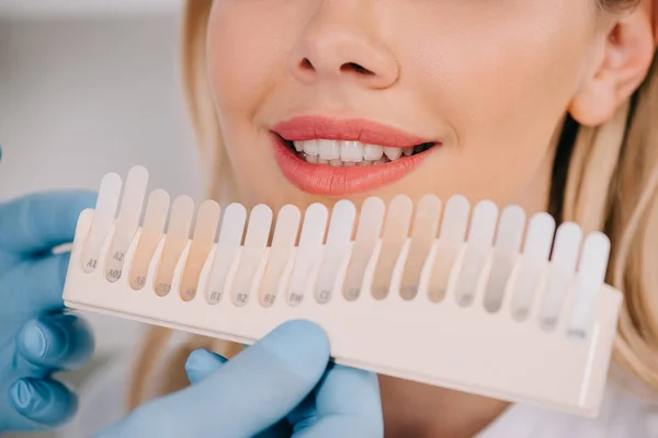 Cropped view of male dentist matching teeth color of woman with palette in clinic, teeth whitening concept — Stock Photo