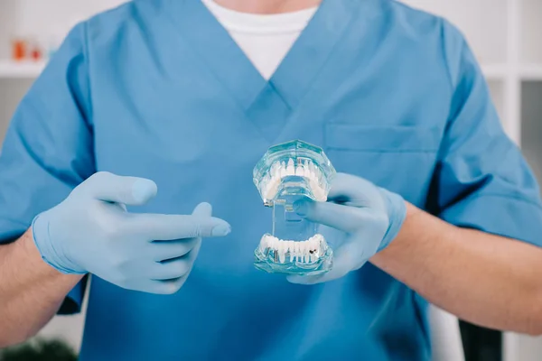 Vue recadrée de l'orthodontiste pointant avec le doigt vers le modèle de mâchoire en clinique — Photo de stock