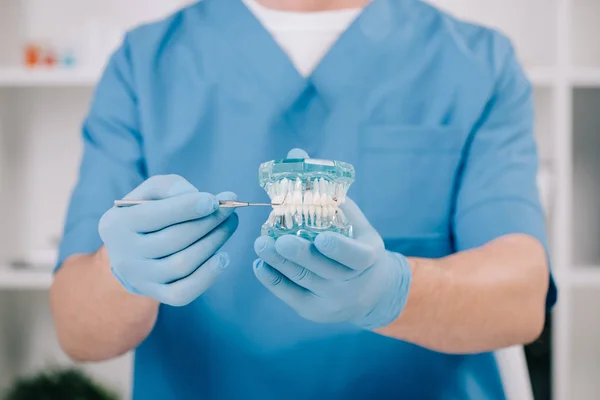 Vue recadrée de l'orthodontiste tenant modèle de mâchoire en clinique — Photo de stock