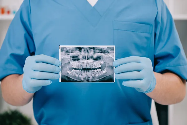 Vista recortada de ortodoncista sosteniendo los dientes de rayos X en la clínica - foto de stock