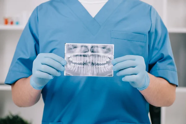 Vista recortada de ortodoncista sosteniendo los dientes de rayos X en la clínica - foto de stock