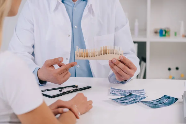 Обрізаний вид на стоматолога в білому пальці, вказуючи пальцем на кольорову палітру зубів в клініці — стокове фото