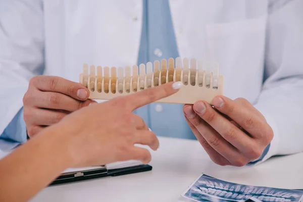 Ausgeschnittene Ansicht einer Frau, die mit dem Finger auf die Farbpalette der Zähne zeigt, während der Konsultation mit dem Zahnarzt — Stockfoto