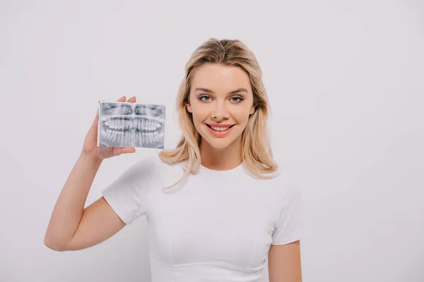 Beautiful woman in t-shirt holding teeth x-ray isolated on white — Stock Photo