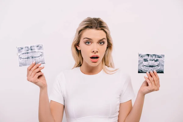 Shocked woman in t-shirt holding teeth x-rays isolated on white — Stock Photo