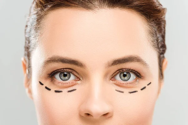 Cropped view of woman with marks on face isolated on grey — Stock Photo