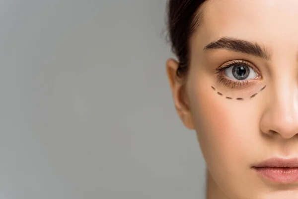 Young woman with marks on face looking at camera isolated on grey — Stock Photo