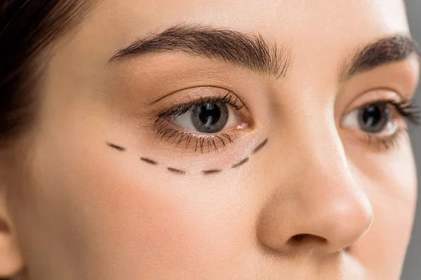 Ausgeschnittene Ansicht einer jungen Frau mit Flecken im Gesicht isoliert auf grau — Stockfoto