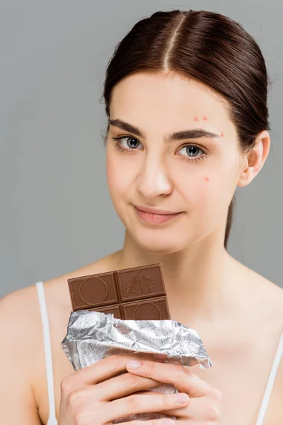 Молода брюнетка з прищами на обличчі тримає шоколадний батончик ізольовано на сірому — стокове фото