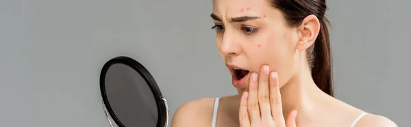 Plan panoramique de femme choquée avec acné sur le visage regardant miroir isolé sur gris — Photo de stock