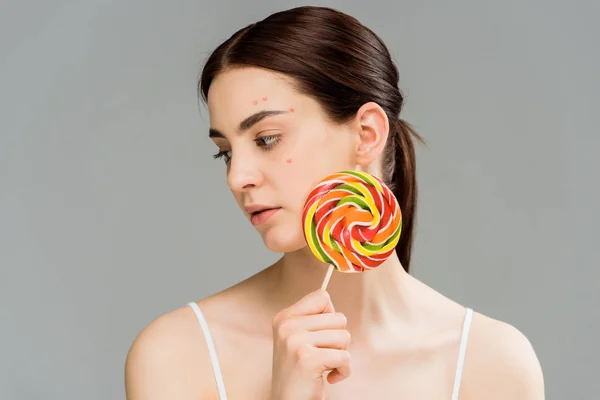 Young brunette woman with acne on face holding sweet lollipop isolated on grey — Stock Photo