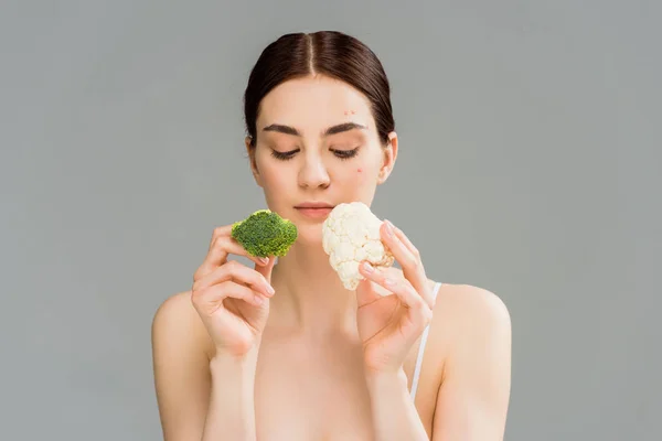 Joven morena con acné en la cara sosteniendo brócoli y coliflor aislado en gris - foto de stock