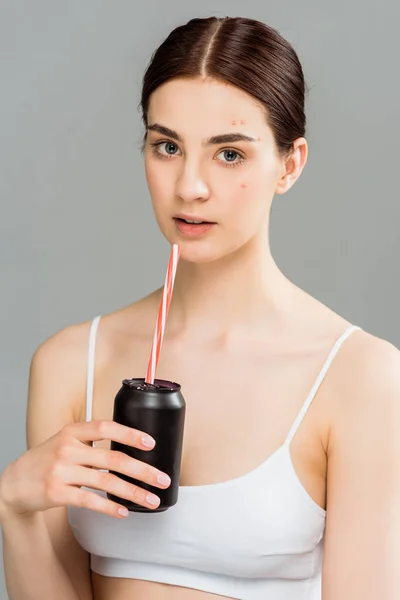Young woman with acne on face holding can with straw isolated on grey — Stock Photo