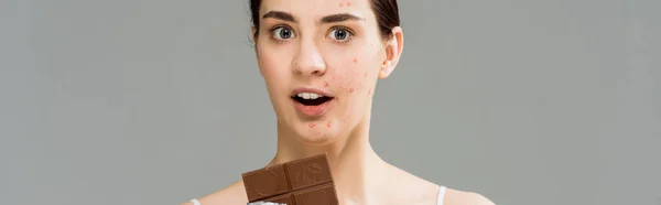 Tiro panorâmico de mulher morena surpreso com acne na cara segurando barra de chocolate isolado no cinza — Fotografia de Stock