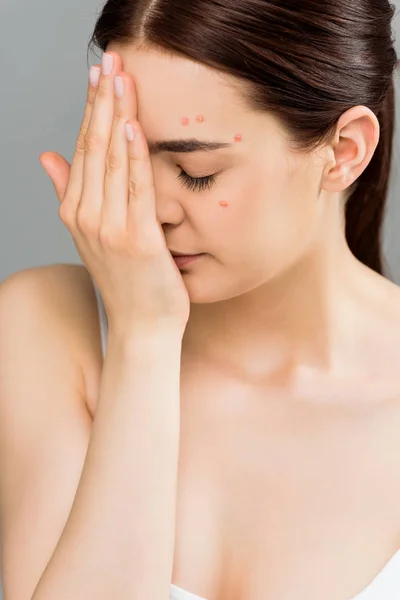 Mujer joven con los ojos cerrados y la cara cubierta de acné con la mano aislada en gris - foto de stock