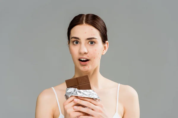 Surprised brunette woman with acne on face holding chocolate bar isolated on grey — Stock Photo