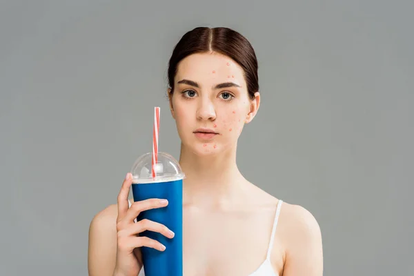 Upset young woman with acne on face holding plastic cup isolated on grey — Stock Photo