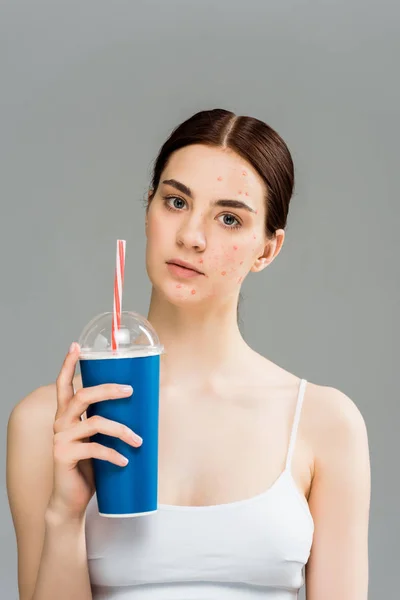 Sad young woman with acne on face holding plastic cup isolated on grey — Stock Photo