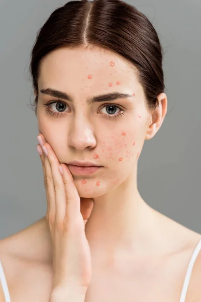 Triste femme brune avec boutons touchant visage isolé sur gris — Photo de stock