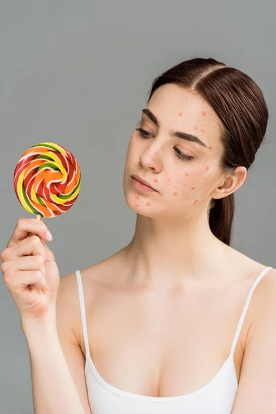 Young brunette woman with acne on face looking at sweet lollipop isolated on grey — Stock Photo