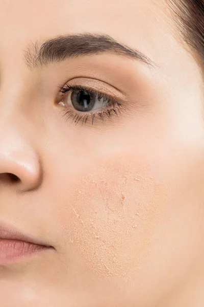 Cropped view of young woman with problem skin — Stock Photo