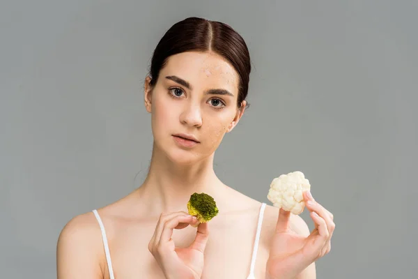 Mujer joven con exfoliación facial en la piel sosteniendo brócoli y coliflor aislados en gris - foto de stock