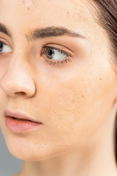 Close up of young woman with problem skin — Stock Photo