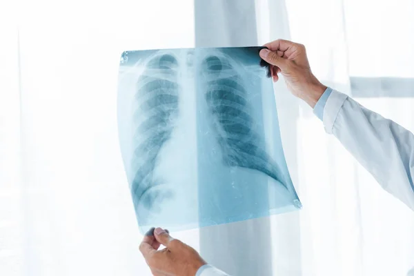 Обрізаний вид лікаря, який тримає рентген в лікарні — стокове фото