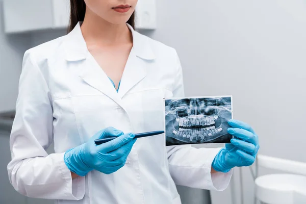 Vista recortada do dentista em luvas de látex azul segurando caneta perto de raio-x — Fotografia de Stock