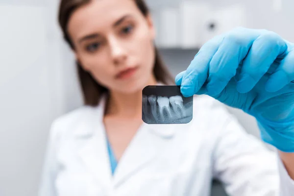 Selective focus of x-ray in hand on attractive dentist — Stock Photo