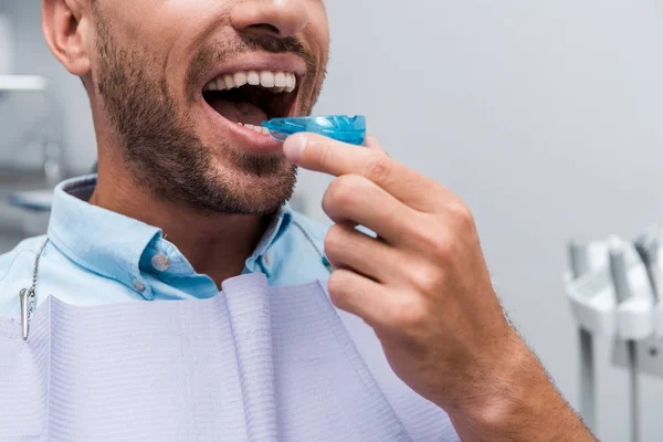 Cropped view of bearded man putting retainer in mouth — Stock Photo