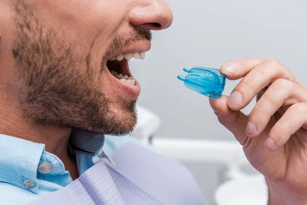 Cropped view of bearded man with opened mouth holding retainer in clinic — Stock Photo