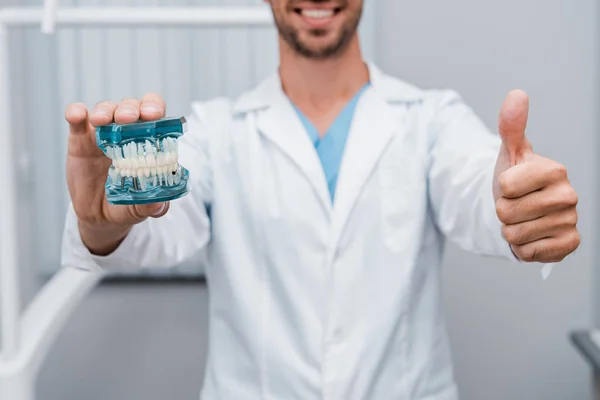 Vista ritagliata del dentista barbuto con modello di denti e mostrando pollice in alto — Foto stock