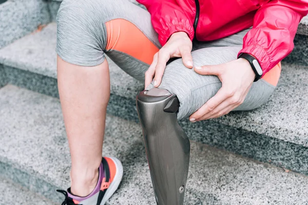 Partial view of disabled sportswoman with prosthesis sitting on stairs — Stock Photo