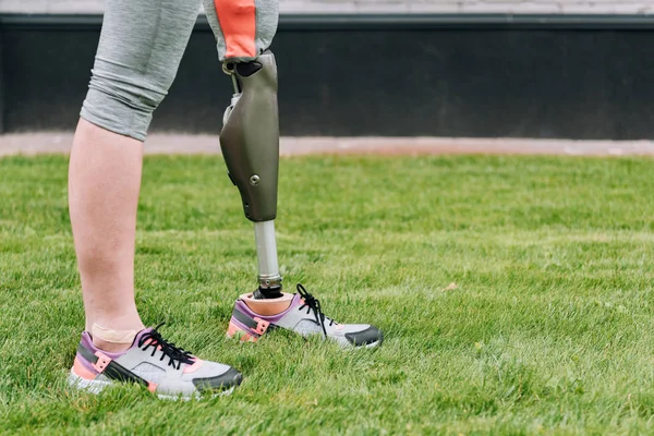 Vue partielle d'une sportive handicapée debout sur l'herbe dans la rue — Photo de stock