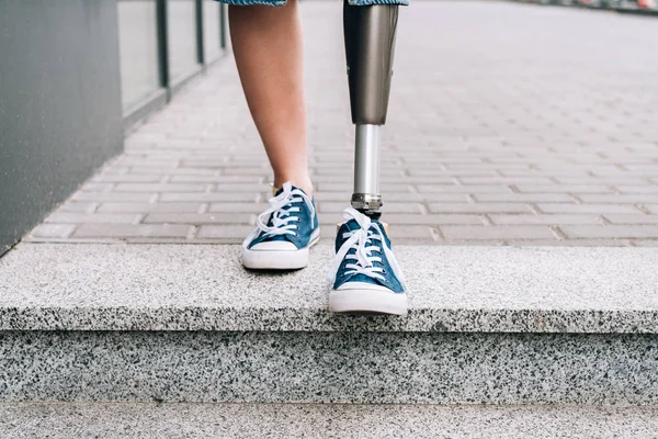 Cropped view of disabled woman with prosthetic leg on street — Stock Photo