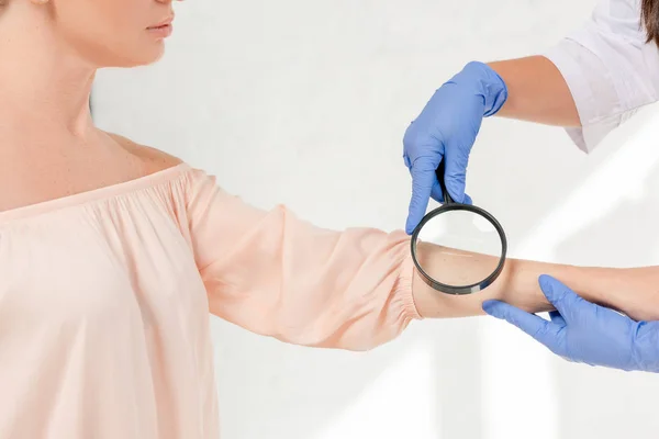 Vista ritagliata del dermatologo esaminando la pelle del paziente con lente di ingrandimento in clinica — Foto stock