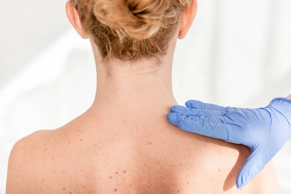 Visão cortada de dermatologista examinando a pele do paciente na clínica — Fotografia de Stock