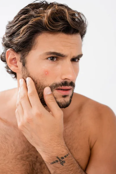 Homem preocupado com acne na bochecha isolado no cinza — Fotografia de Stock