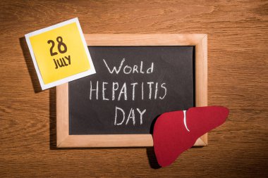 top view of blackboard with lettering world hepatitis day, liver and stick it with lettering 28th july on table clipart