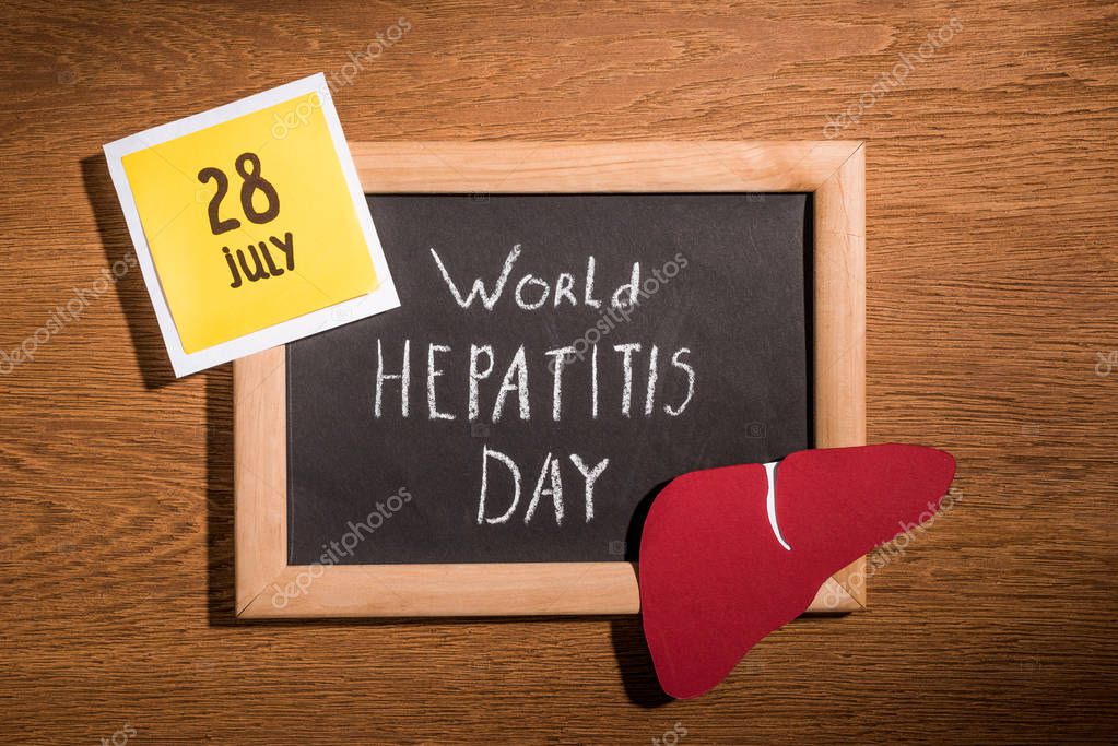Top view of blackboard with lettering world hepatitis day, liver and stick it with lettering 28th july on table