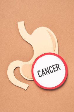 view from above of human stomach and lettering cancer on beige clipart