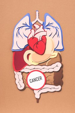 flat lay with human internal organs and lettering cancer on brown clipart