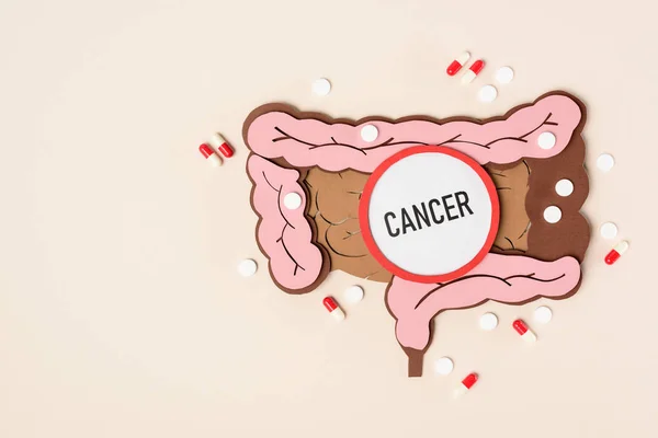 Bovenaanzicht Van Menselijke Dikke Darm Verschillende Pillen Belettering Kanker Beige — Stockfoto