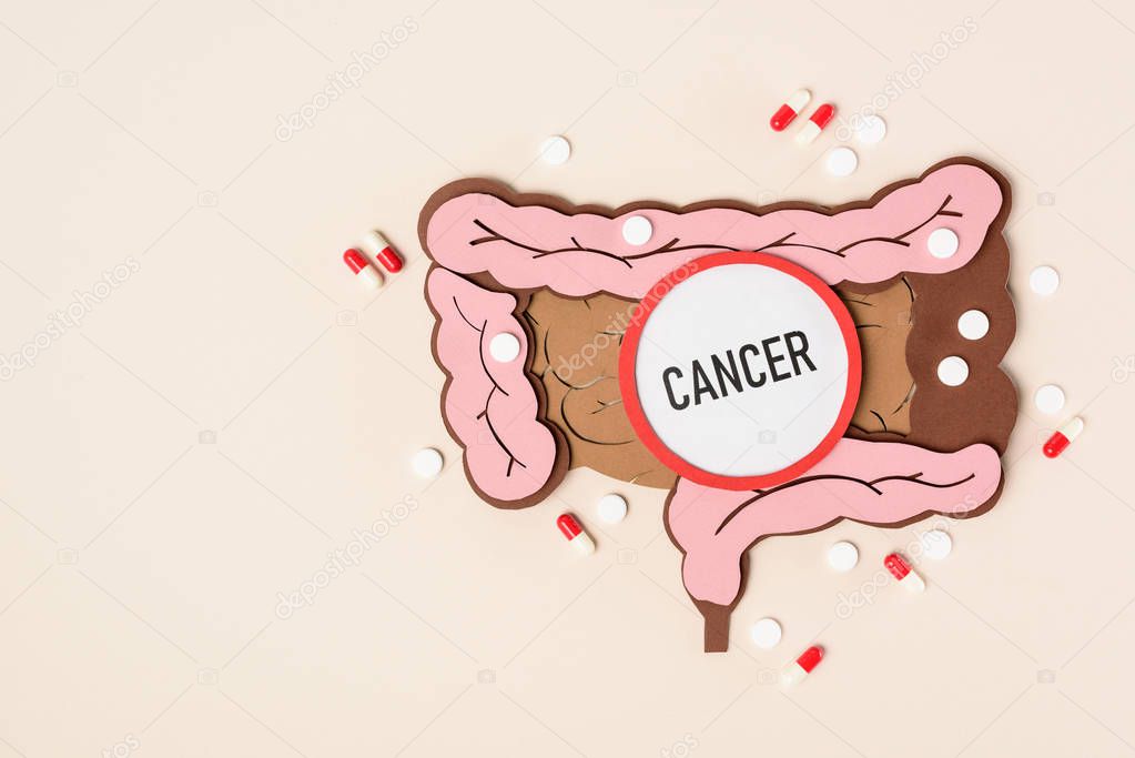 top view of human large intestine, various pills and lettering cancer on beige