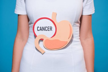 cropped shot of woman with paper crafted stomach and cancer lettering on blue background clipart