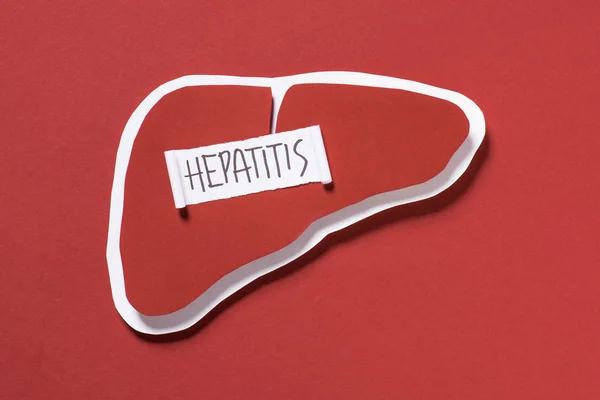 Vista superior del hígado y las letras de la hepatitis en el fondo rojo, concepto del día mundial de la hepatitis - foto de stock